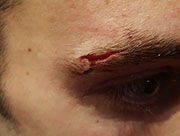 ceja abierta boxeo